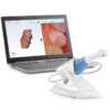 Planmeca Emerald S Intraoral Scanner - Image 2