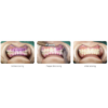 AP-B Dental Air Polisher and Ultrasonic Scaler Unit - Image 3